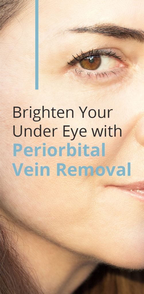 Brighten Your Under Eye with Periorbital Vein Removal Vein Health